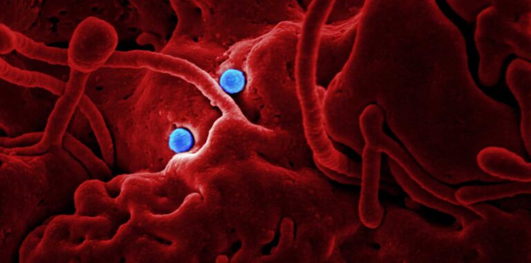 Coronavirus disease (COVID-2019) R&D
